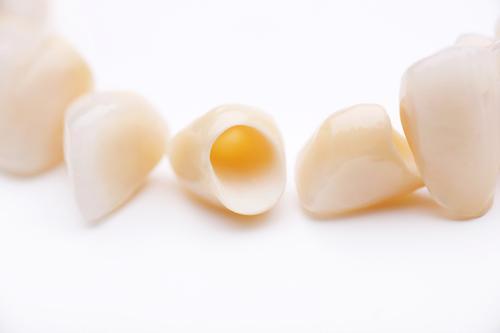 Close up of dental crowns at Apex dentist office